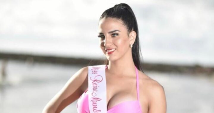 Reina de belleza rompe el silencio y denuncia brutal agresión de su expareja