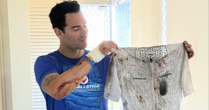 Renato Prono agradece estar con vida luego de un accidente en ruta